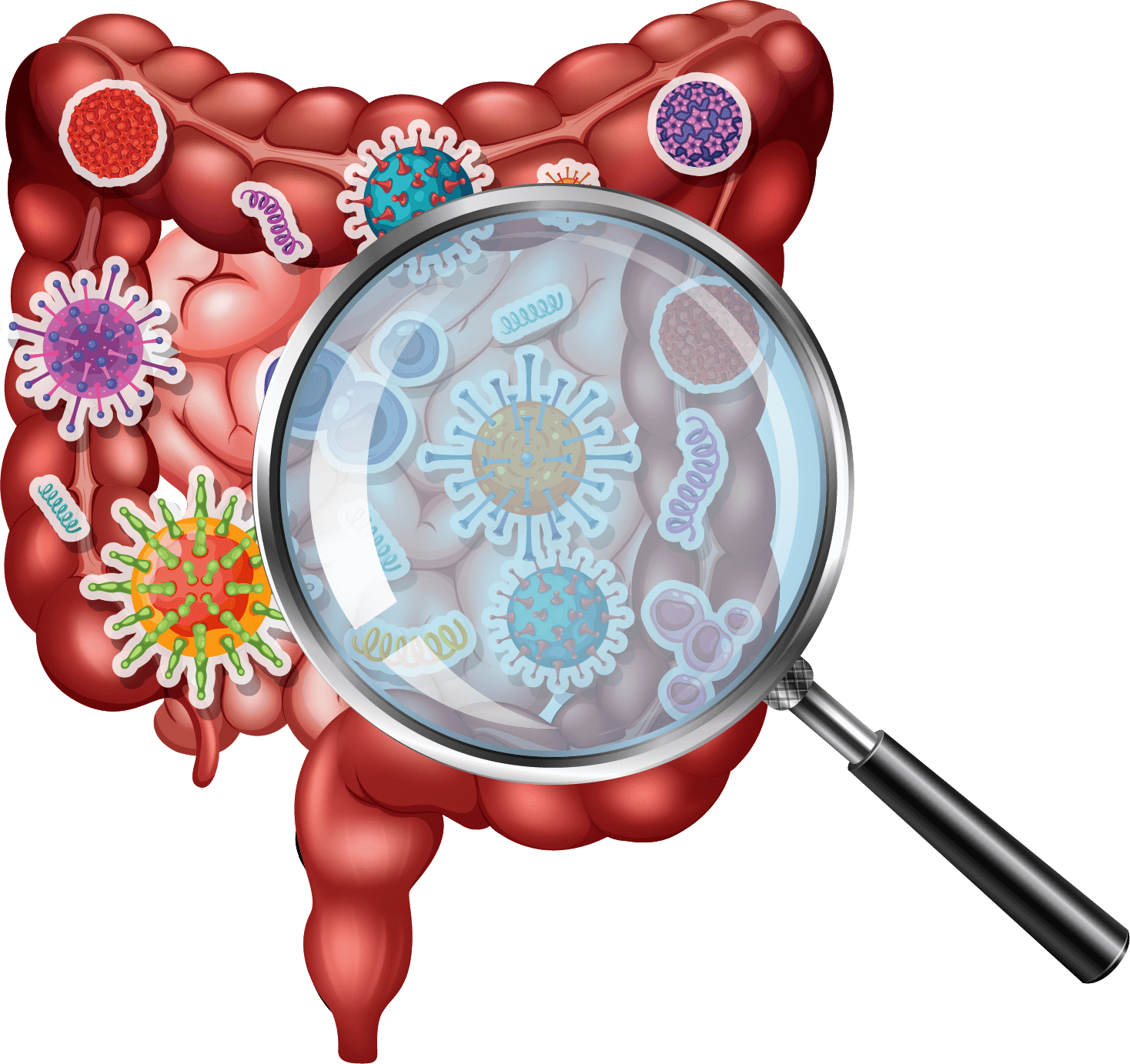 intestino inflamado